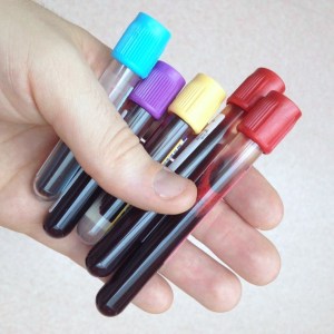 vacutainerbloodbottles